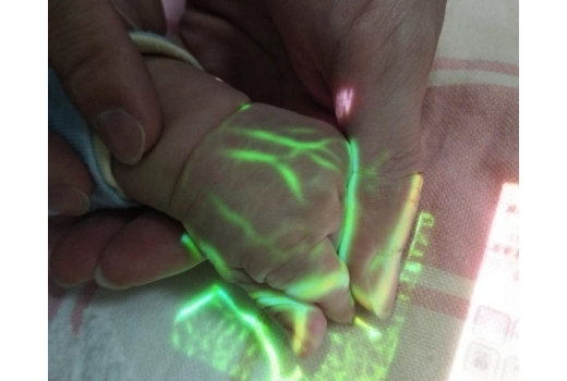 Система кольорової візуалізації вен - 7