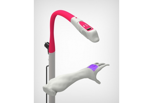 Система кольорової візуалізації вен - 3