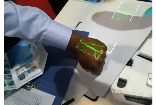 Система кольорової візуалізації вен - 11