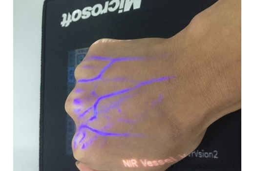 Система кольорової візуалізації вен - 12