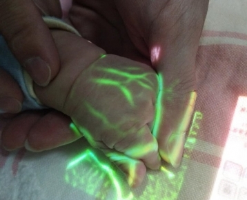 Colorful Vein Imaging System