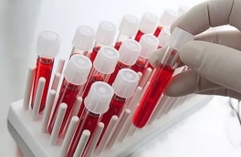 It is interesting! 9 major blood indicators of your health