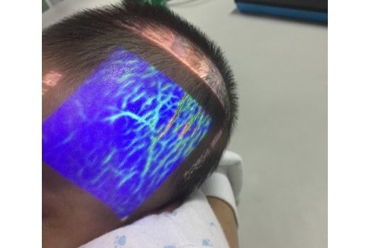 Система кольорової візуалізації вен - 9