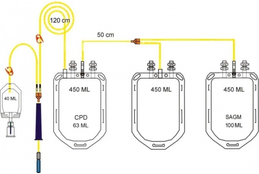 Контейнер для крови WEGO с растворами CPD-SAGM 450/450/450 мл с аксессуарами - 3