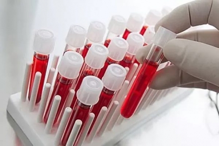 Это интересно! 9 главных показателей крови вашего здоровья
