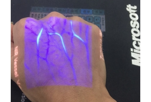 Система кольорової візуалізації вен - 8