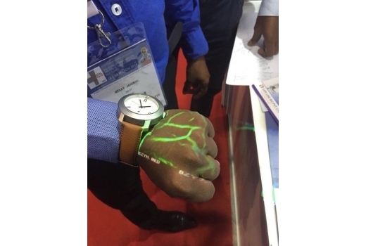 Система кольорової візуалізації вен - 10