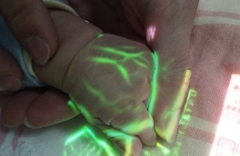 Colorful Vein Imaging System